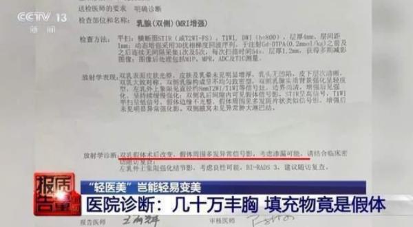 丰胸产品惊现动物源性成分，女子健康遭遇潜在风险